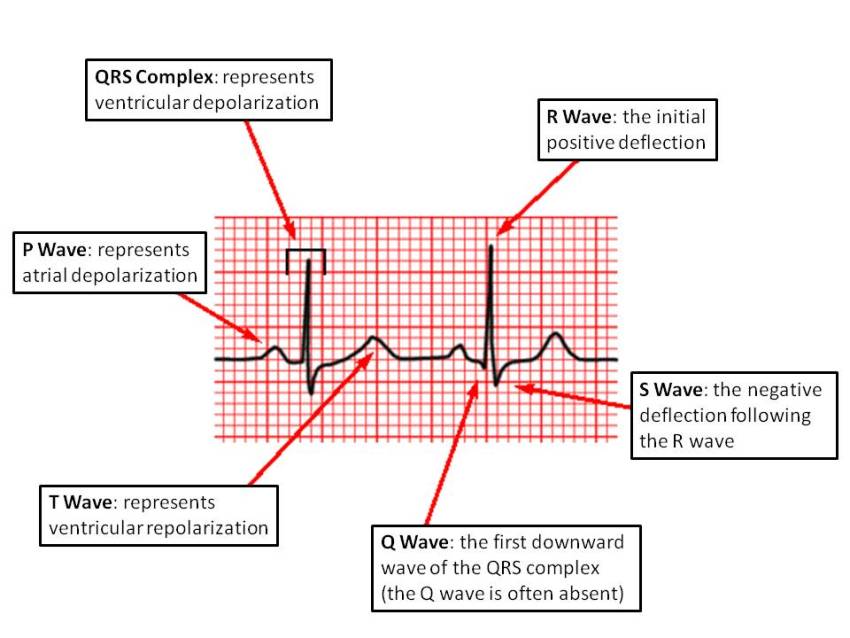 Image result for what do waves represent in an ecg
